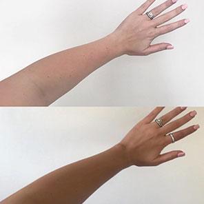 tanned model in MineTan Violet Self Tan Foam